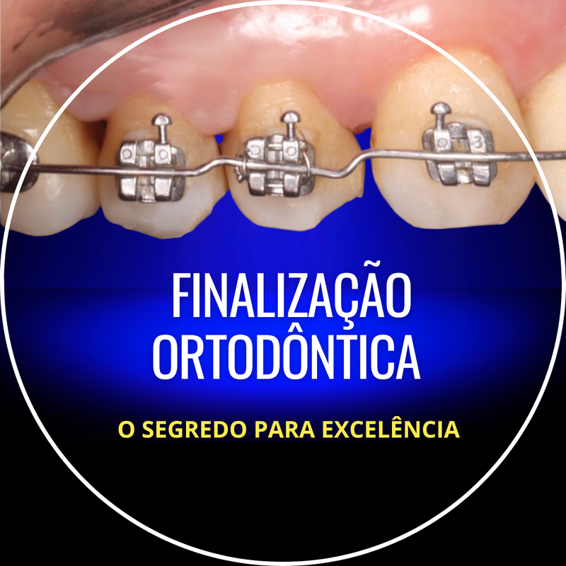 Finalização Ortodôntica