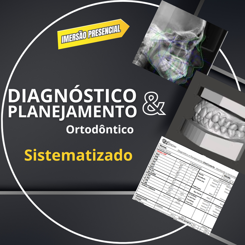 Diagnóstico e Planejamento Sistematizados na Ortodontia. - Mentoria