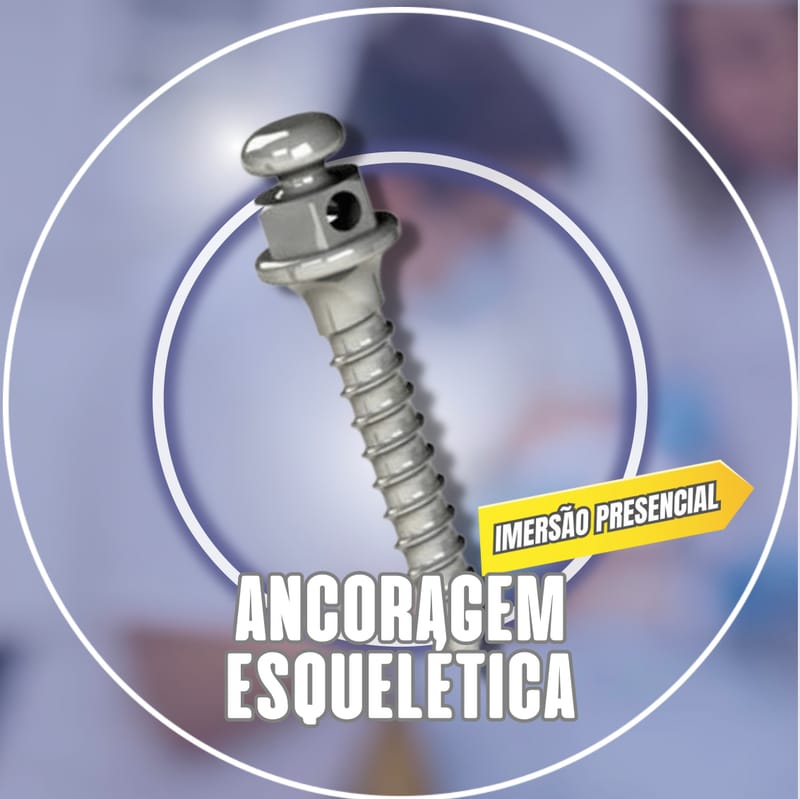 Ancoragem Esquelética com Mini-Implantes