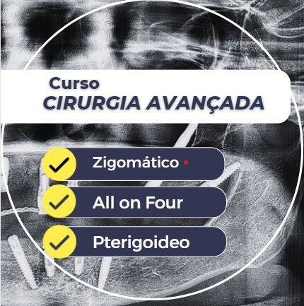 Cirurgias Avançadas - All On Four Standard ou Zigoma