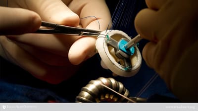 La chirurgie valvulaire