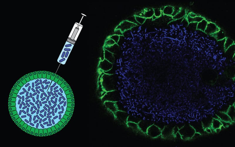 Theme 2: Tracking the origin of cancer