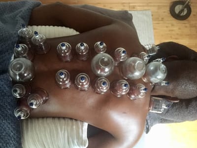 Cupping image