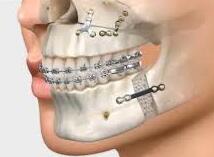 Tratamientos Quirúrgicos