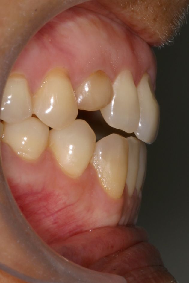 Si soy adulto y aun  TENGO DIENTES DE LECHE