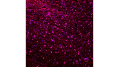 biomodelo em agressividade image