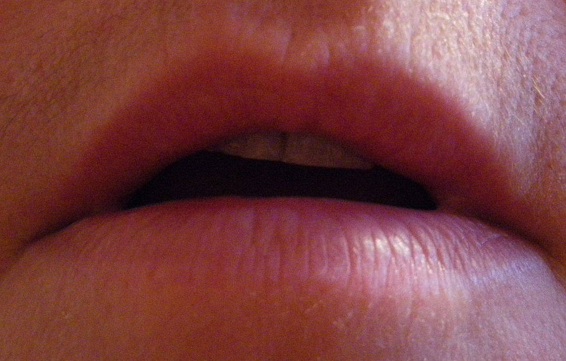 Has Anyone Told You?