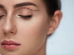 Various Types Of Eyelid Surgery