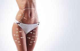 The 411 On The Liposuction Procedure