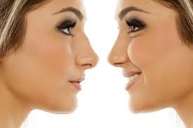 Finding A Good Rhinoplasty Doctor