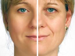 Facelift Alternatives - Cheaper, Risk-Free and Safer Option To Tighten That Saggy Facial Skin
