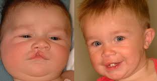 Improve Your Looks Through Plastic Surgery Centers