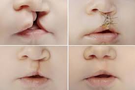 Unique Plastic Surgery Benefits People May Not Be Aware Of