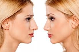 Nose Jobs, the Good the Bad and the Ugly