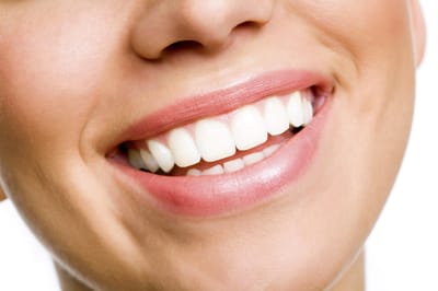 Which Home Teeth Whitening Kits Are Best?