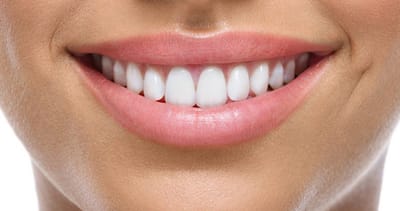 Teeth Whitening - Brighter Teeth Are Possible Without Draining Your Bank Account