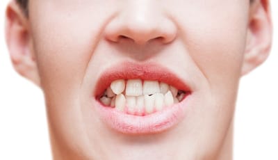 How Do I Know If I Am Getting My Wisdom Teeth?