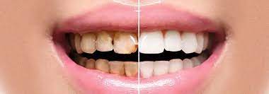 Cosmetic Dentistry Information & Help Finding a Cosmetic Dentist Near You