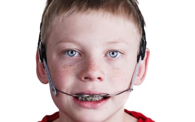 Orthodontic Treatment Is Not Just For Kids