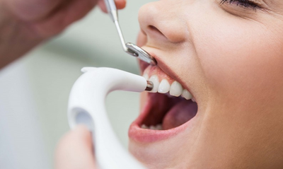 What Is Dental Scaling and Root Planning?