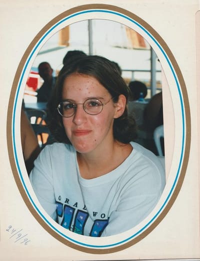 מה הקשר בין פצעונים, חומץ ונטורל פורמולה?