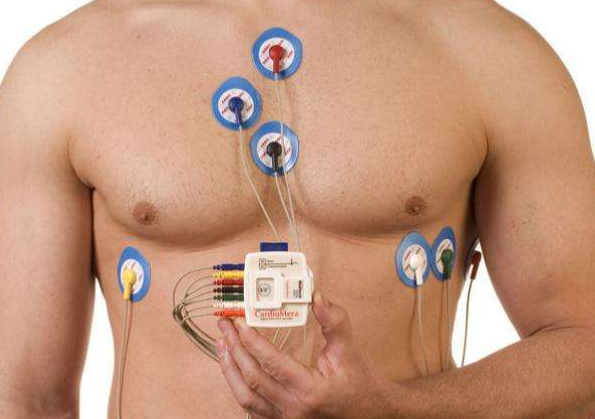 Holter EKG