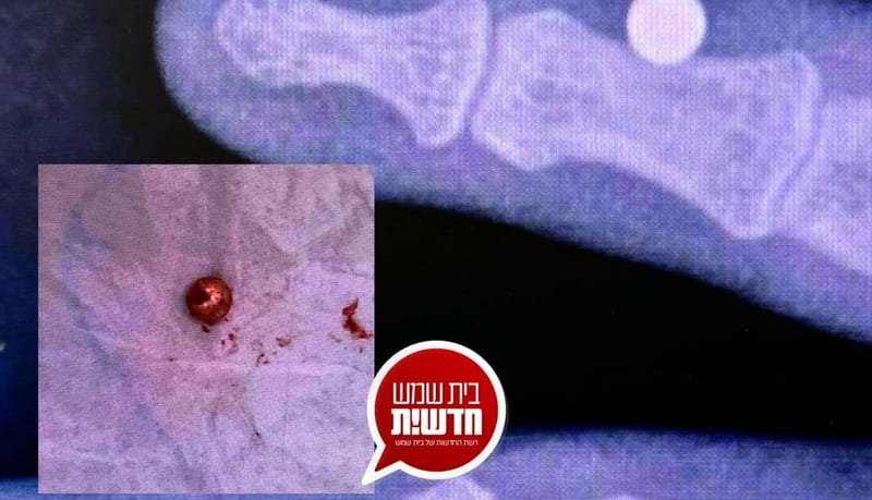 הוגש כתב אישום: תושב בית שמש ביקש להחזיר סמים שרכש - נורה על ידי סוחר הסמים באקדח איירסופט