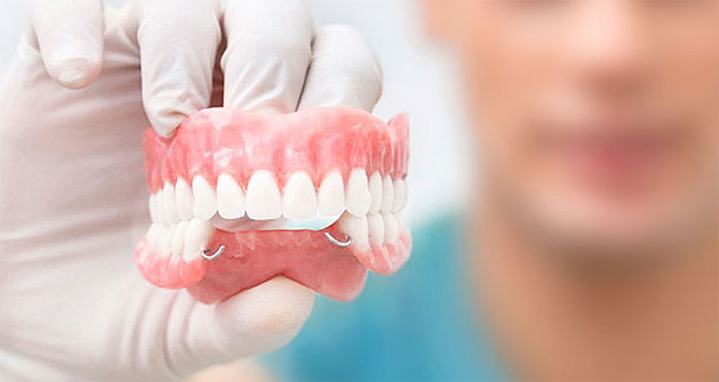 REHABILITACIÓN ORAL
