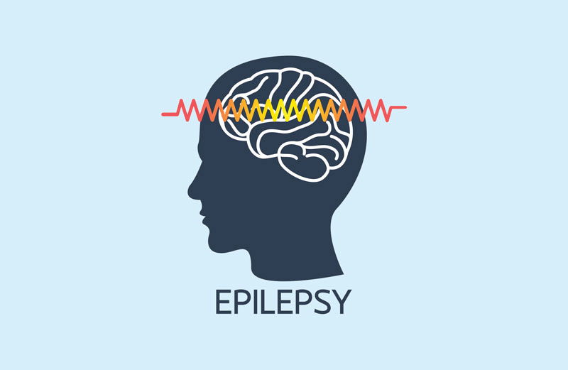 Causes of Seizures