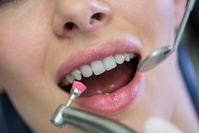 Tips to Make Your Dental Implants Last a Lifetime