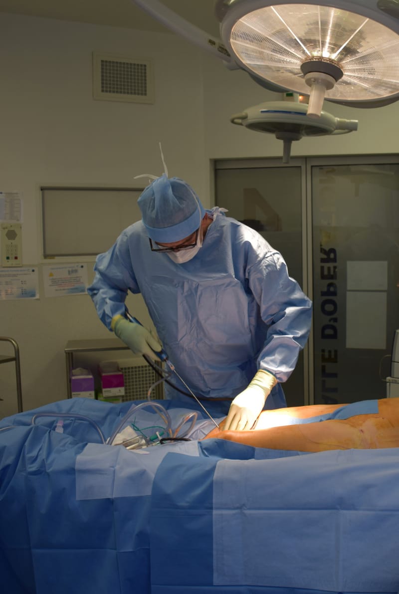 OPERATION
