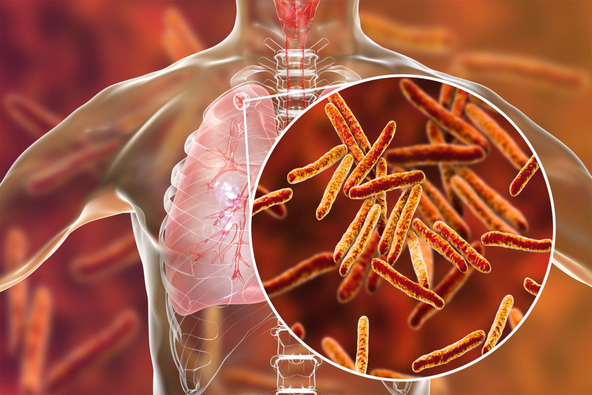 MEDICAL MICROBIOLOGY-MYCOBACTERIUM