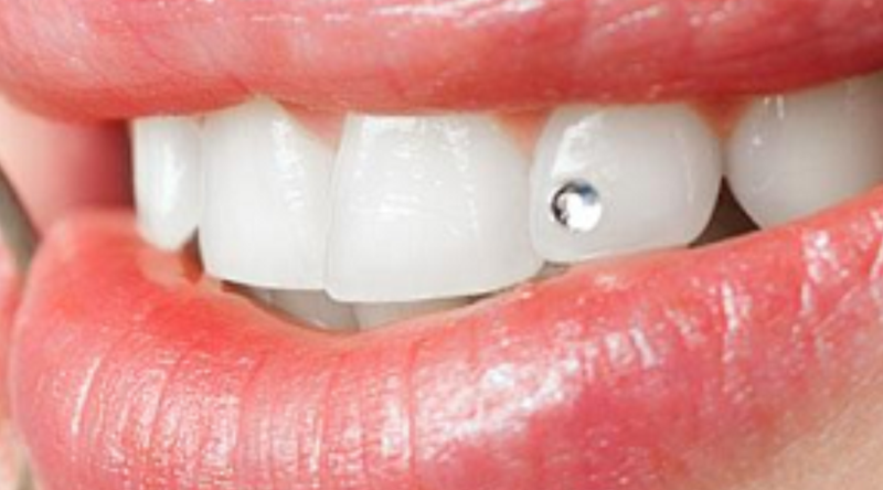 Piercing Dental