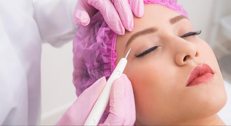 Eletrocauterização estética