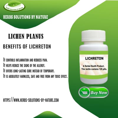 Lichreton, Lichen Planus Can Be Treated Using Natural Remedies