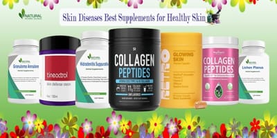 Best Supplements for Reducing Skin Disease Symptoms