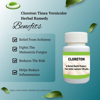 Home Remedies to Cure Tinea Versicolor Fastest Way to Heal It