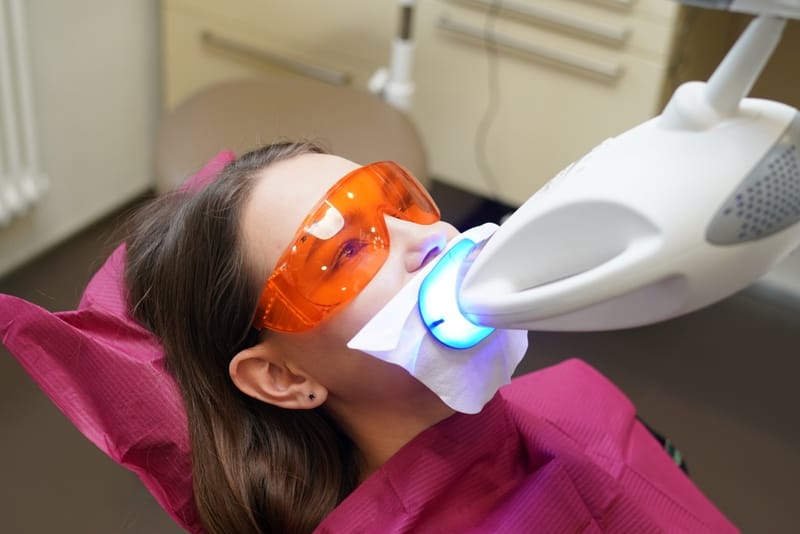 Teeth bleaching newer methods and methods