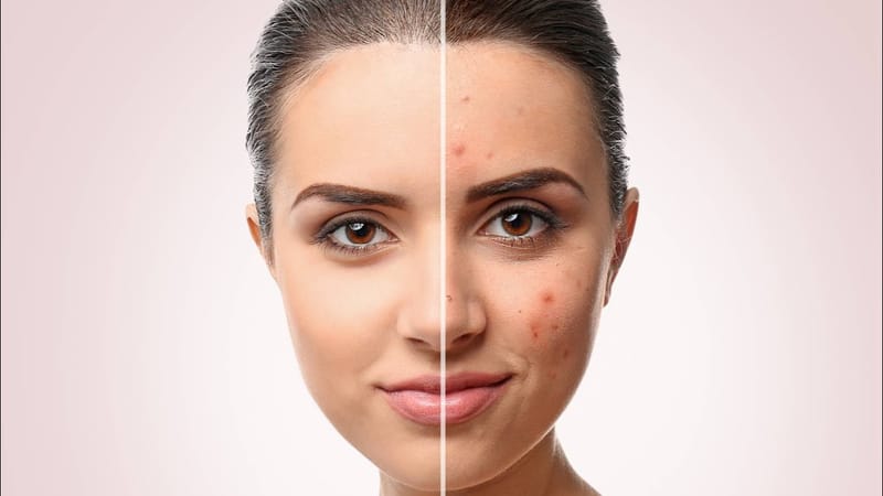 Non-surgical techniques in unifying skin tone and removing facial pigmentation