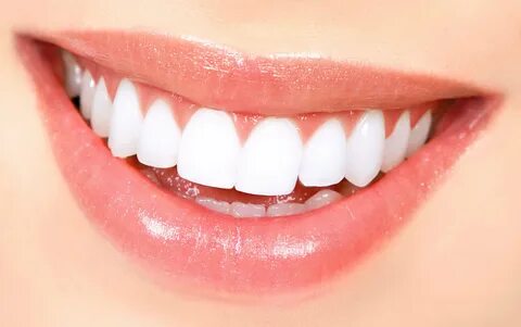 Teeth whitening with flash technology