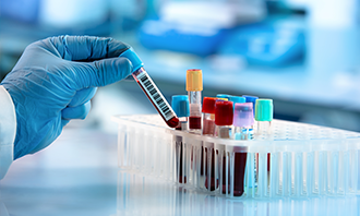 Laboratory App Development