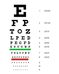 Macular Degeneration: the Diagnosis