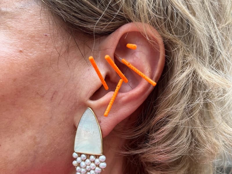 Spring Detox Acupuncture Clinic