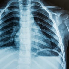 X Ray