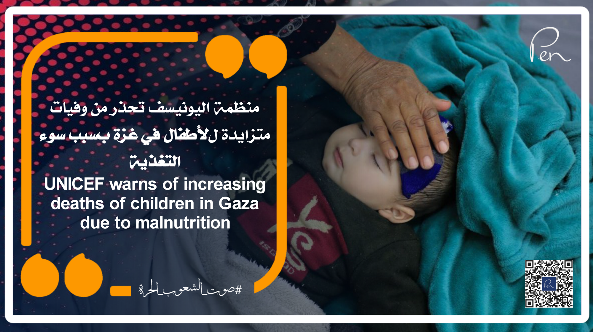 UNICEF warns of increasing deaths of children in Gaza due to malnutrition