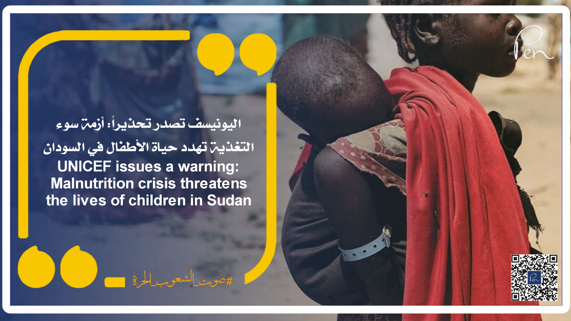 UNICEF issues a warning: Malnutrition crisis threatens the lives of children in Sudan