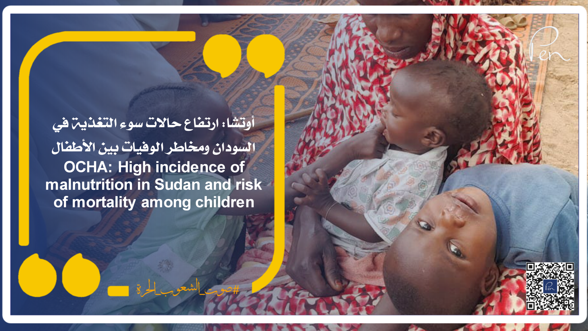 OCHA: High incidence of malnutrition in Sudan and risk of mortality among children