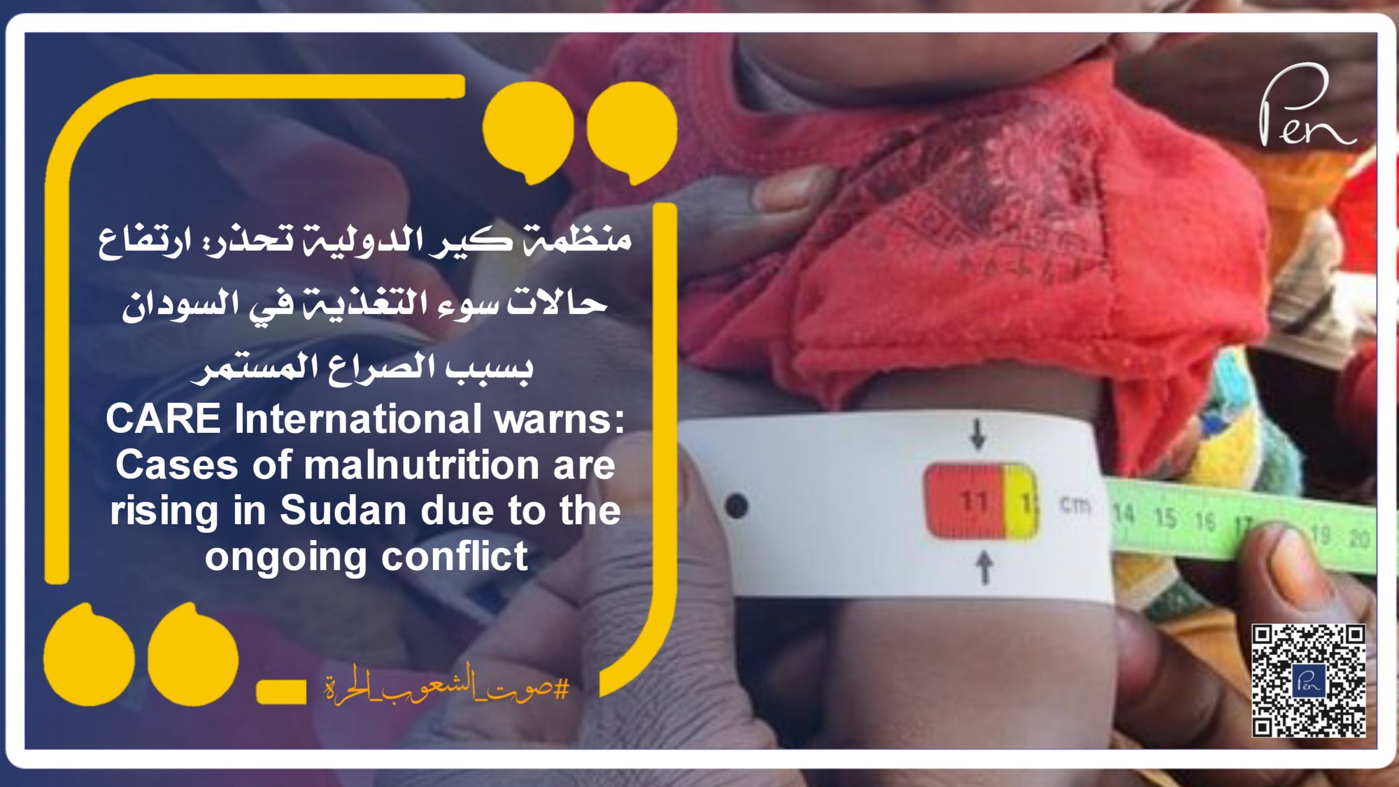 CARE International warns: Malnutrition cases are rising in Sudan due to the ongoing conflict