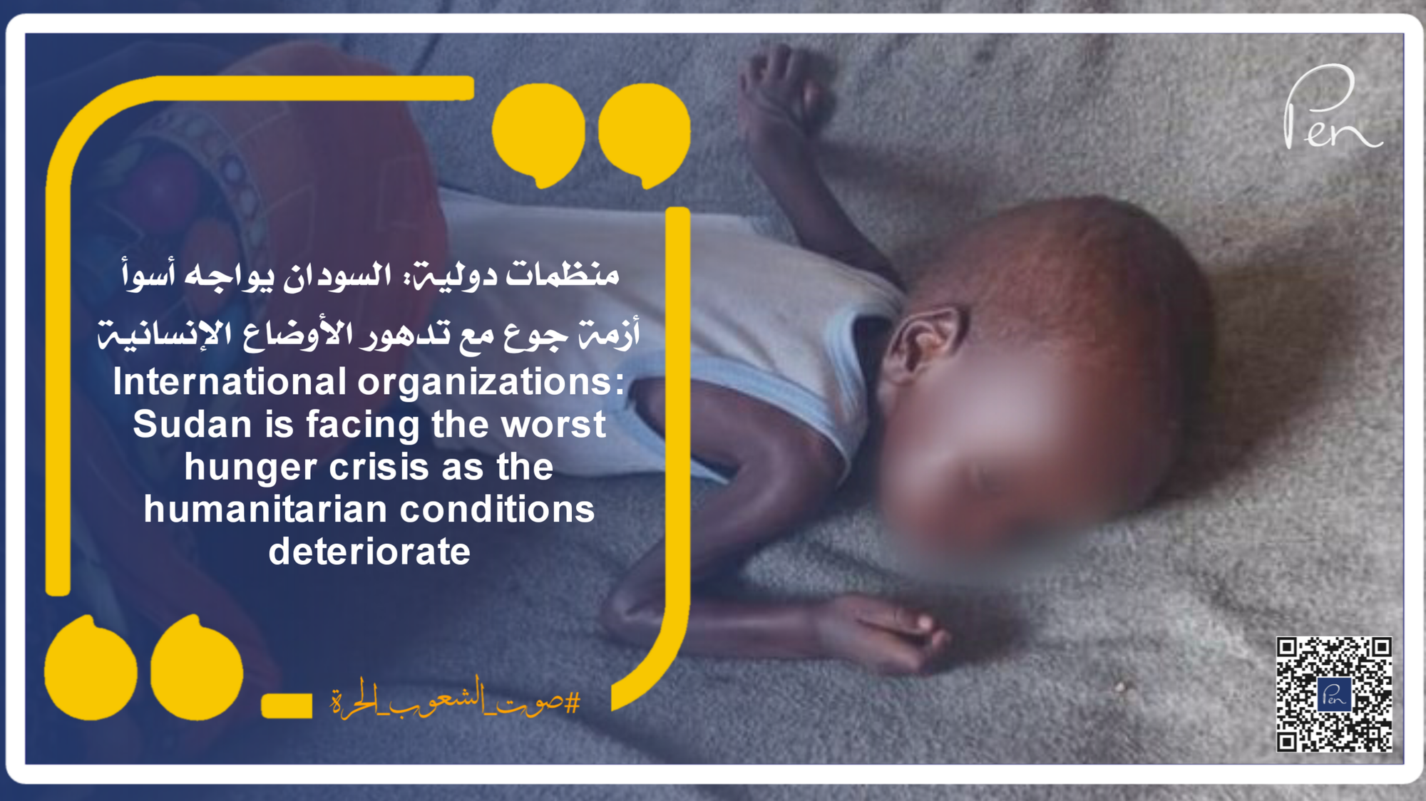 International organizations: Sudan is facing the worst hunger crisis as the humanitarian conditions deteriorate