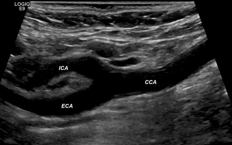 Ultrasound Healthy Screen